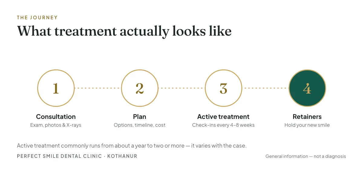 Four-stage timeline: consultation, plan, active treatment, retainers