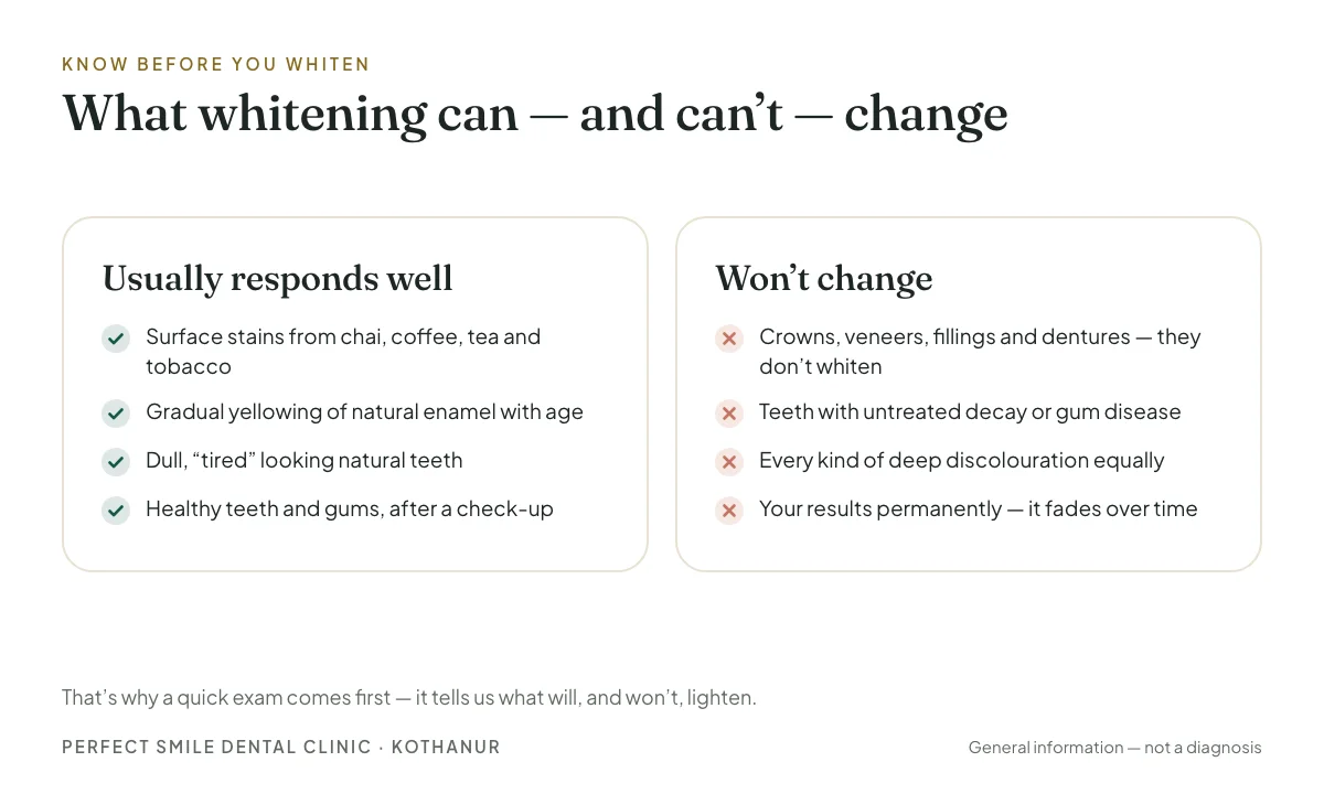Two-column infographic of what whitening usually responds to and what it will not change
